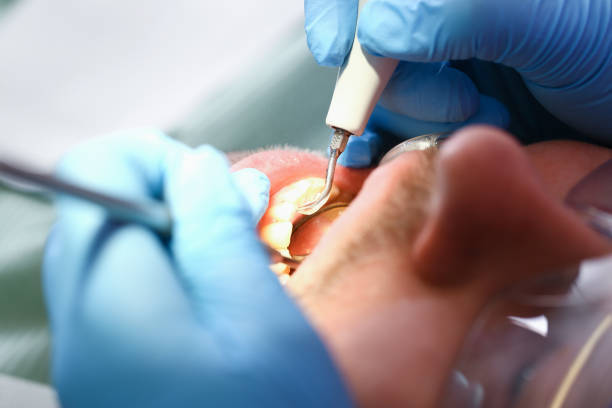 Best Emergency Tooth Extraction in Lonoke, AR