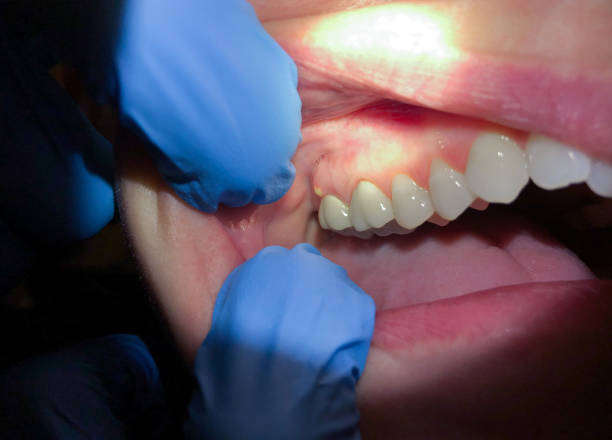 Best Weekend Emergency Dentist in Lonoke, AR